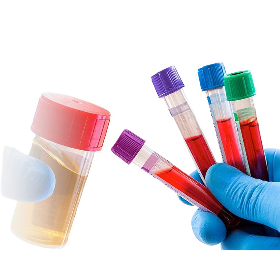 NTL Extraction Kits — specimen types